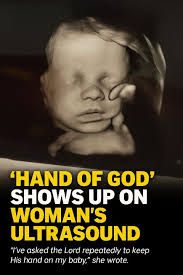 Pregnant woman shares miracle ultrasound image of baby with heart condition