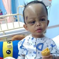 Also known as * on. Ibu Tak Sangka Terhantuk Biasa Menyebabkan Bayi Alami Pendarahan Di Kepala May 2021 Kelabmama Malaysia