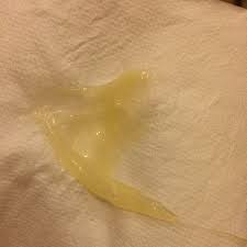 Mucus Plug 40 Weeks Today Lost This Have Slight Cramps How Long After Loosing This Amount Of Mucus Plug Would Labor Usually Begin Glow Community