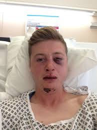 Stockton man lucky to be alive after suffering horrendous facial injuries  after being kicked in face by a horse at Sadberge, near