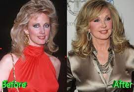 Beth smith dehart, profile picture. Morgan Fairchild Before And After Plastic Surgery Celebrity Plastic Surgery Morgan Fairchild Plastic Surgery