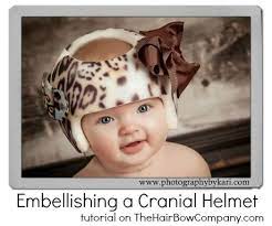 Embellishing A Cranial Helmet Baby Helmet Baby Helmet Design Girls Ideas Cranial Helmet Designs Girl