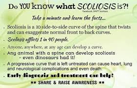 Pin On Scoliosis