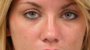 Mom of baby mutilated by dogs set free