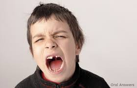 What To Do When Your Child S Baby Tooth Gets Knocked Out Oral Answers