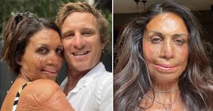 Turia Pitt's 'confronting' photo discovery