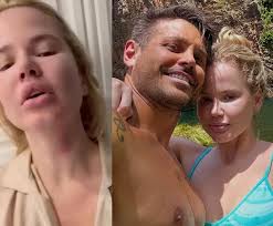 Namorada de Dado Dolabella aparece machucada em vídeo e amiga pede ajuda