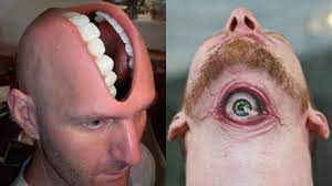 A new trend has recently emerged in the body modification sphere. Chris Morries Medium