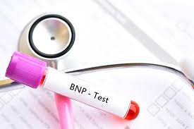 Bnp An Important New Cardiac Test Harvard Health