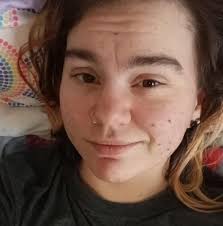 Physical self-care, rest, and space can assist with autistic burnout.  #autism