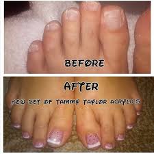 Any Girl Can Have Beautiful Feet Wearing Tammy Taylor Love These Pink And White Toenails By Angelagilmanwilkey At En Pretty Toe Nails Toe Nails Acrylic Toes