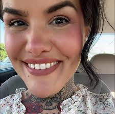 My lip filler results! 👄💉 First video- directly before. Second video- the  day after. Third video- 2 weeks after. Thank you to Nectar Body Solutions  for achieving my perfect results! Don't forget