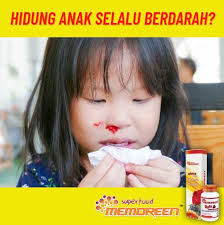 Anterior (paling utama), dan posterior. Rawatan Resdung Kanak Kanak No 1 Pernah Tak Anak Korang Berdarah Hidung Secara Tiba Tiba Punca Punca Hidung Berdarah Disebabkan Beberapa Punca Seperti Kecederaan Udara Terlampau Sejuk Atau Kering Menghembus