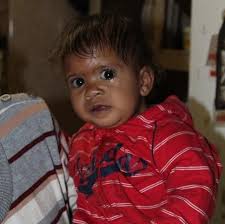 Baby Cassandra fights for her life