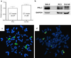 For this test, a blood sample is sent to a laboratory for analysis. Expression Of Prl 3 In Prostate Cancer Cell Lines Pc3 And Du145 Which Download Scientific Diagram