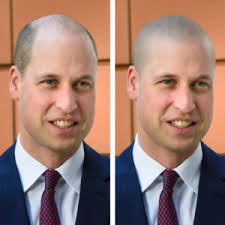 We did not find results for: Prince William S Shaved Head Bald And Proud Skalp