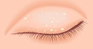 Image result for milium cyst on eyelid