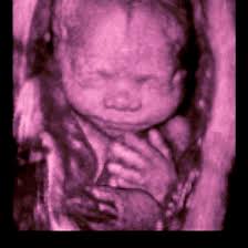 3d Or 4d Ultrasound Vs 2d Ultrasound