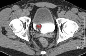 Genitourinary Radiology