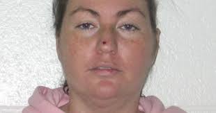 Woman pleads to manslaughter