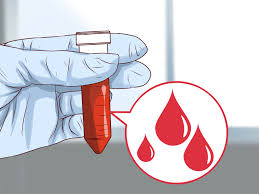 Den Unterschied Zwischen Einer Muskelzerrung Und Lungenschmerzen Erkennen 8 Schritte Mit Bildern Wikihow