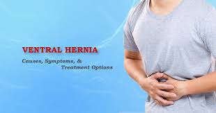 Read about hernia surgery, repair, recovery time, complications, and the different types of hernias. Ventral Hernia Causes Symptoms And Treatment Dr R Padmakumar