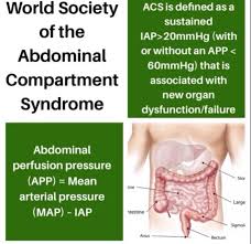 Abdominal Compartment Syndrome Acs Iah App Mmhg Abdomen Guidelines Evidencebased Medicine Pharm Compartment Syndrome Arterial Pressure Abdominal