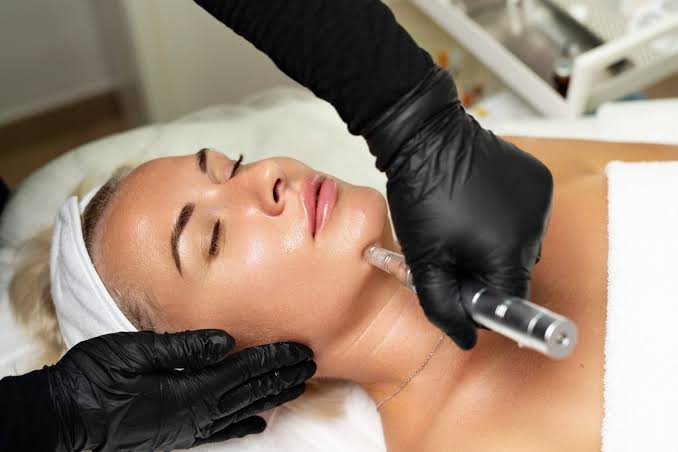 Are Microneedling Results Permanent for Acne Scars - Pennsylvania  Dermatology Specialists