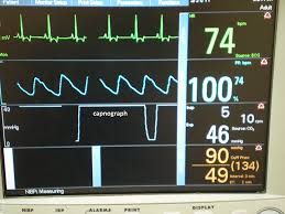 Anesthetic Monitoring Interpreting The Readings