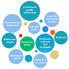 If you or your family or friends notice that you seem to be stooping, leaning or slouching when you stand, it could be a sign of parkinson's disease (pd). A Trembling Parkinson S Disease Cusabio