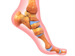 Contohnya persendian pada pergelangan tangan dan kaki, hubungan antara tulang rusuk dan tulang belakang dan tulang tulang dada, dan hubungan tulang kemaluan. Cara Memperkuat Pergelangan Kaki