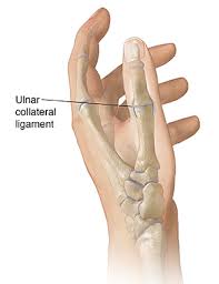 A gamekeeper's thumb, also called a skier's thumb, is an injury to one of the important ligaments at the injury involves the ulnar collateral ligament (ucl) , of the thumb, a band of tough, fibrous tissue. A Patient S Guide To Ulnar Collateral Ligament Injuries Of The Thumb Hand And Upper Limb Clinic