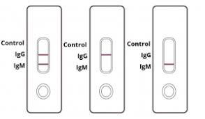 Covid 19 Igm Igg Rapid Test Kit Coronavirus Covid 19 Antibody Test