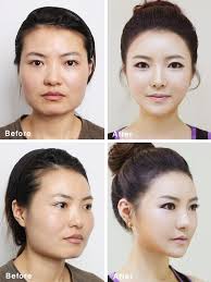 If You Want To Be Beautiful You Ll Have To Buy A New Face On Plastic Surgery Self Esteem In Korea Korean Plastic Surgery Plastic Surgery Celebrity Plastic Surgery