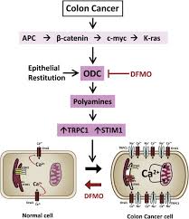 Although cancer isn't as common in cats as it is in dogs, it still affects a number of our feline friends. Trpc1 And Orai1 Channels In Colon Cancer Sciencedirect