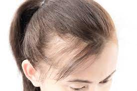 Heavy layers tent to thin the bottom out even more, so that adds to a thinner, more scraggly appearance overall. What To Do About Thinning Hair Blog Keranique