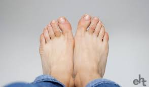 How To Remove Hard Skin Get Silky Soft Feet In 5 Easy Steps Expert Home Tips