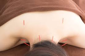 ãé¼æ²»çãç»åãã®ç»åæ¤ç´¢çµæ