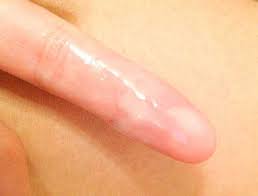 Keputihan tanda hamil dan keputihan haid bisa dibedakan berdasarkan volume, waktu kemunculan, tekstur, dan warnanya. Wanita Wajib Tahu 7 Jenis Keputihan Ini Secrets Living