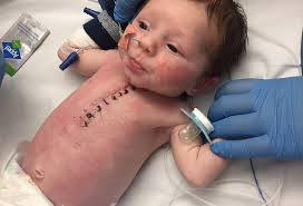 Beteja për mbijetesë, foshnja 7 ditësh iu nënshtrua operacionit në zemër