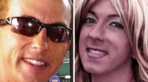 Un estadounidense se convierte en mujer por los efectos secundarios de un  crecepelo