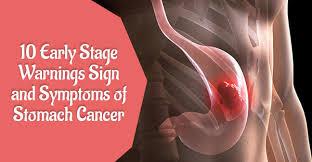 Left untreated, gastritis may lead to stomach ulcers and stomach bleeding. 10 Early Stage Warnings Sign And Symptoms Of Stomach Cancer
