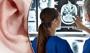 Tinnitus is the perception of sound when no corresponding external sound is present. Tinnitus Treatment Ear Ringing Linked To Changes In The Brain Express Co Uk