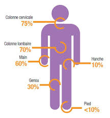 Quelles sont les articulations touchées ? L Arthrose Le Mal Des Articulations