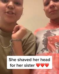 I Shaved My Head So My Sister Could Have My Hair