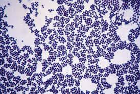 Gram positive cocci (gpc) gram neg (rods = gnr) anaerobes atypicals classification antibiotic cluster = staph. Gram Positive Cocci In Clusters Download Scientific Diagram
