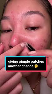 Peace Out Acne Pimple Patch