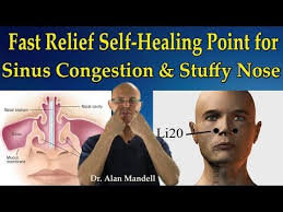 Fast Relief Self Healing Point For Sinus Congestion Stuffy Nose Headaches Dr Mandell Youtube Sinus Infection Relief Sinus Allergies Sinus Drainage