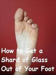 How To Get A Shard Of Glass Out Of Your Foot Foot Remedies How To Remove Feet