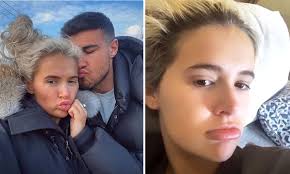 Watch popular content from the following creators: Love Island Star Molly Mae Hague In Agony After Boyfriend Tommy Fury Accidentally Breaks Her Nose Hello